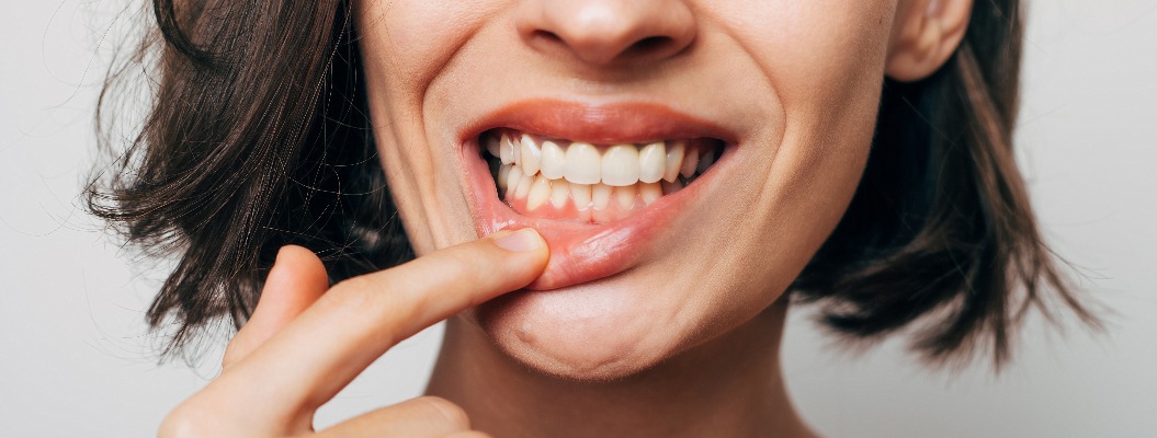 Eine Person zeigt lächelnd ihre Zähne, hebt die Lippe an. Kurzes, dunkles Haar.