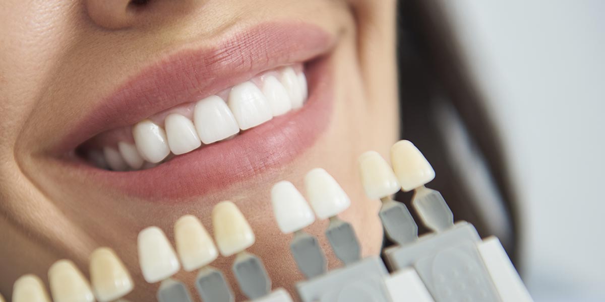 Zahnersatzmodelle werden an Zähne zum Abgleich hin gehalten