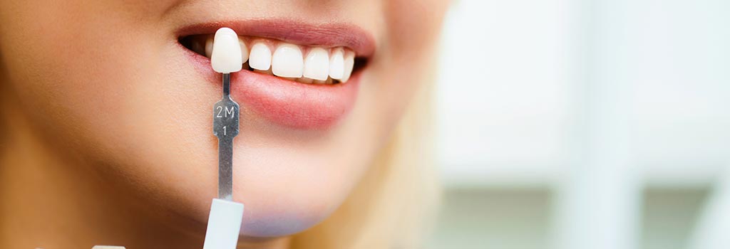 Frau hält Zahnprothese vor Gebiss